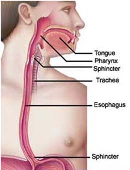 Surgery Esophageal Cancer, Esophageal Cancer Surgery