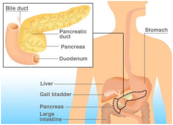 India Surgery Pancreas Cancer, Cost Pancreas Cancer, Pancreas Surgeon, Cancer Pancreas